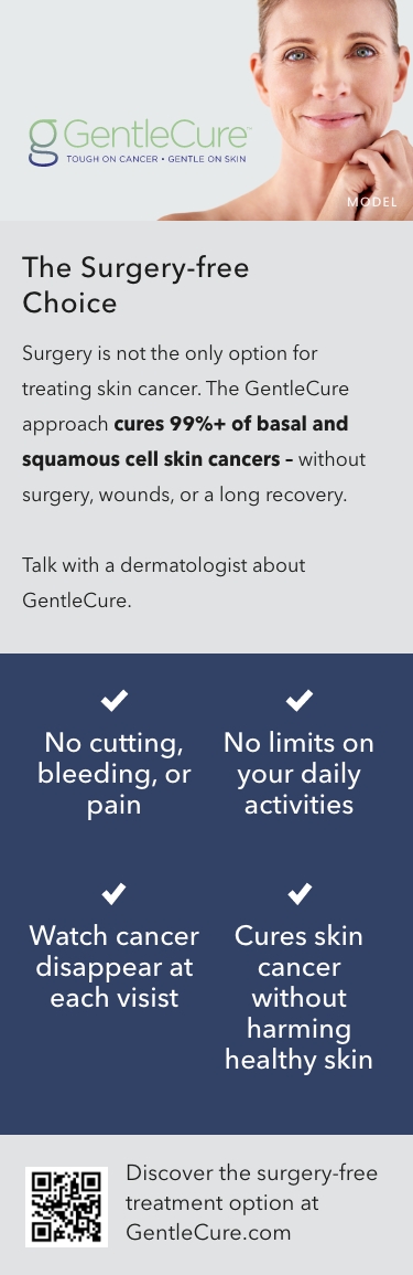 Discover the surgery-free skin cancer treatment option at gentlecure.com