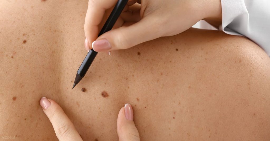 A doctor examining a patient's back with a pencil. (Models)